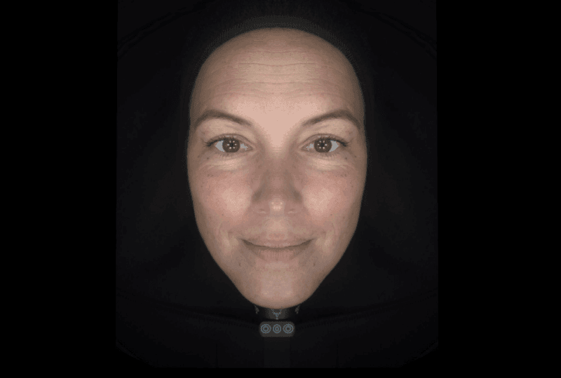 facial-symmetry-rr
