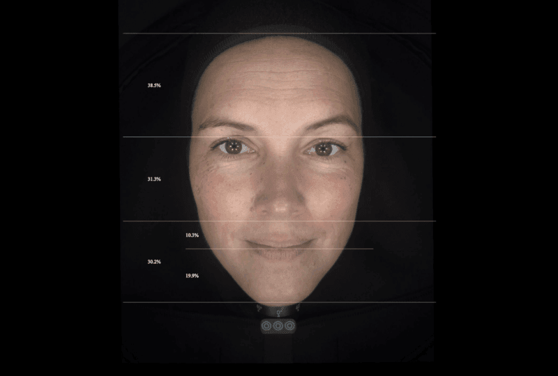facial-thirds