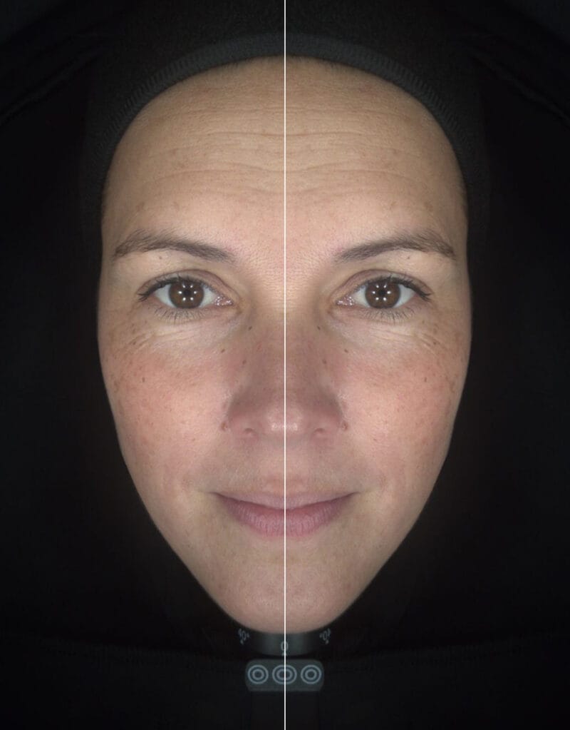 facial symmetry 2
